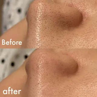 Lilyboo 池袋のエステ・リラクイメージ