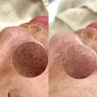 Suu.今池/千種 眉毛サロンの眉毛・アイブロウイメージ