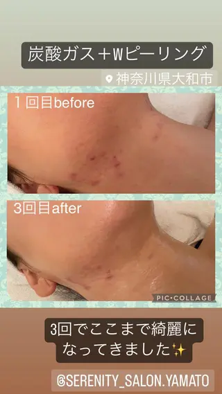 Serenity salonのエステ・リラクイメージ