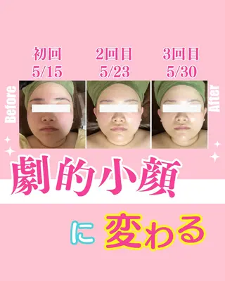 バスト美肌小顔専門 Mimpi【ミンピ】のエステ・リラクイメージ