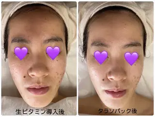 COCO beautyサロンのエステ・リラクイメージ