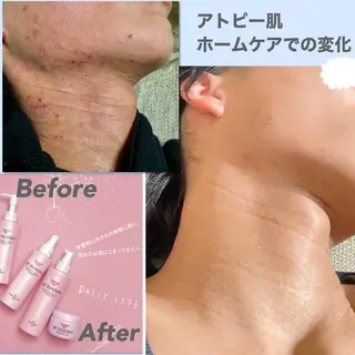 aimer beautyのエステ・リラクイメージ