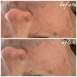 メンズ メナード岐阜茜部 杉浦のエステ・リラクイメージ