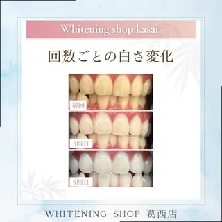 メンズ ホワイトニング ショップ葛西店のその他イメージ