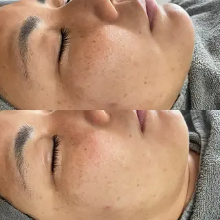 Its Yoshikaのエステ・リラクイメージ