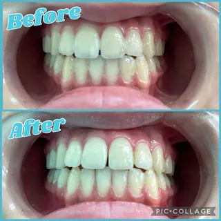 セルフホワイトニング COCOSHIROのエステ・リラクイメージ