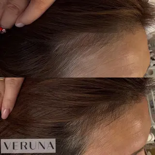 ハーブピーリング専門 葵/LUNEAのエステ・リラクイメージ