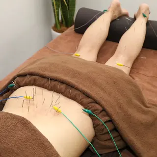 Spring鍼灸院 ✨首肩こり、腰痛に！のその他イメージ