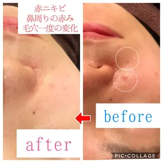 ミディアム カラー パーマ ヘアアレンジ メンズ キッズ ネイル マツエク・マツパ 金の糸脱毛 産毛ケア専門のエステ・リラクイメージ