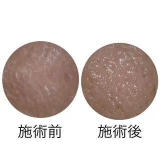 メナード丸の内ヒルズ 柳田りさのエステ・リラクイメージ