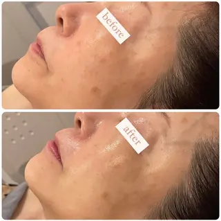 立体小顔×艶肌×美ボ ディ似合わせ施術 岡のエステ・リラクイメージ