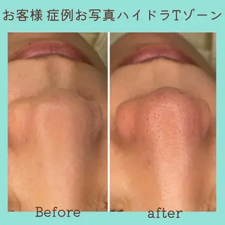 E LINDAのネイルデザイン