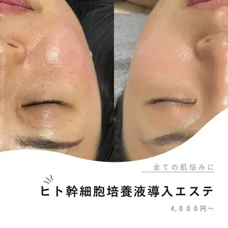 Lyf salon.のエステ・リラクイメージ