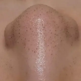 毛穴/肌管理/痩身/ ボディケア/satoのエステ・リラクイメージ