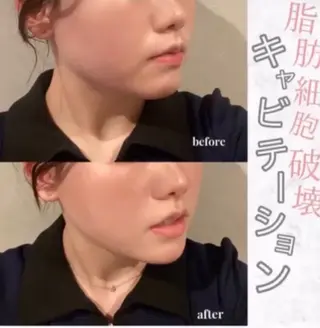 Beauty Max Astudioのその他イメージ