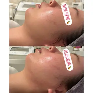 小顔コルギ ☆表参道/外苑前のエステ・リラクイメージ