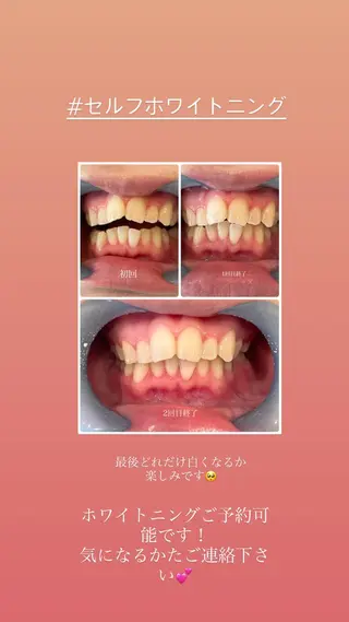 Lune nailのネイルデザイン