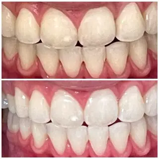 メンズ DIAMOND BEAUYのその他イメージ