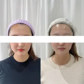 毛穴に特化したサロン MYFAIRLADYのエステ・リラクイメージ