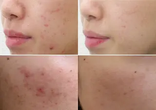 全身脱毛＆VIO脱毛 紹介率№1♪リナ♪のエステ・リラクイメージ