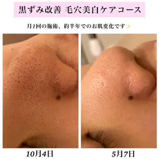 Bellesthe (ベルエステ)のエステ・リラクイメージ