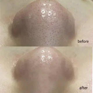 Dahlia Beautyのマツエク・マツパデザイン