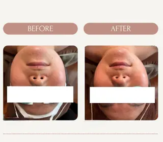 ピーリング＆脱毛 maoのエステ・リラクイメージ