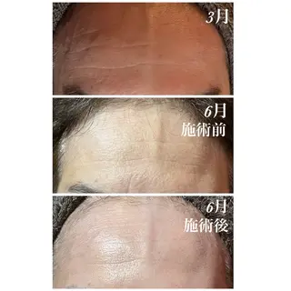 結果重視｜毛穴エステ ｜友綱理恵のエステ・リラクイメージ