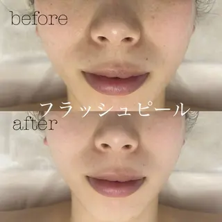 メンズ フェイシャルサロン CHIARA 荒田のエステ・リラクイメージ