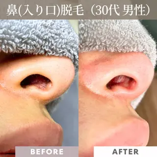 メンズ 【一本ずつ脱毛】 ReMove 柏のエステ・リラクイメージ