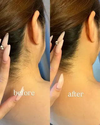 うなじ脱毛/美肌脱毛 LABELのエステ・リラクイメージ