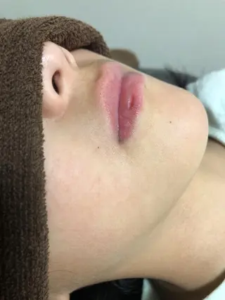 chou chou シュシュのエステ・リラクイメージ