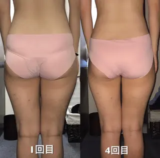 足から整える体メンテ Re:アールイーのその他イメージ