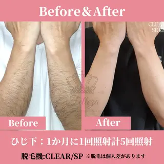 メンズ 有人型セルフサロン 脱毛／痩身／美顔のエステ・リラクイメージ