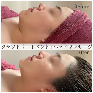 深層筋×筋膜リリース 首肩こり/むくみのエステ・リラクイメージ