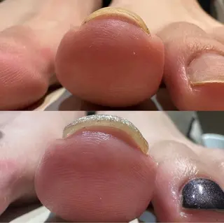 ネイル レナークアリア ネイリスト高橋のネイルデザイン