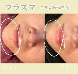 池田 桃花のエステ・リラクイメージ