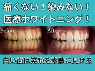 Platinum Beauty 四条烏丸店所属・吉田亮利 ホワイトニング専門店のその他イメージ