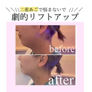 小顔・リフトアップ/ 奈緒美のエステ・リラクイメージ