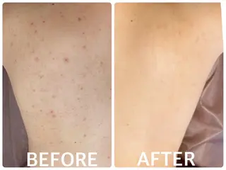 ハーブピーリング横浜 肌質改善専門店のその他イメージ