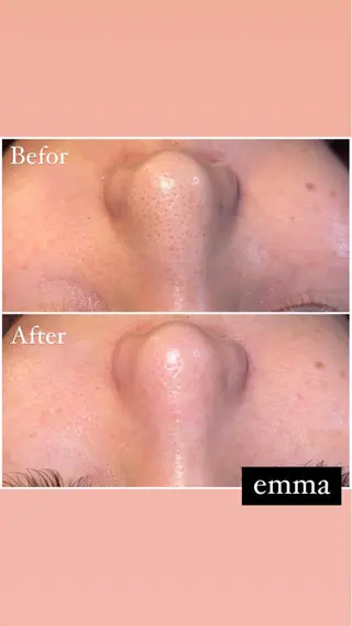 プライベートサロン emma【エマ】の眉毛・アイブロウイメージ