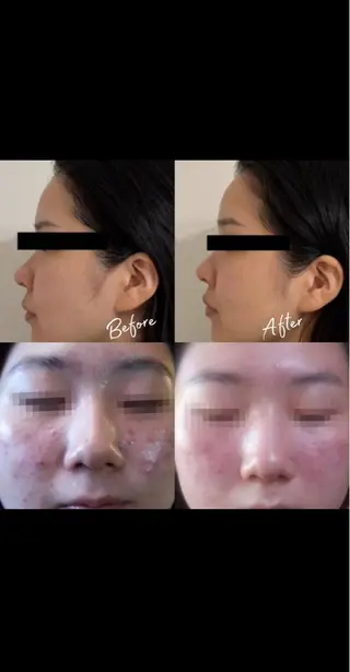 アンジェリック ビーナス　Rinonのエステ・リラクイメージ