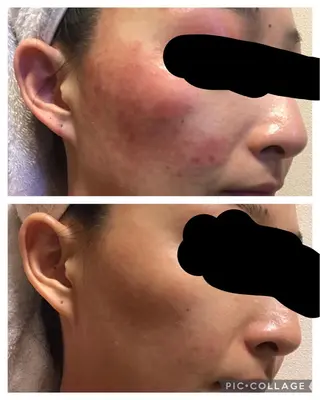 朝重い人専用 肩甲骨調整のエステ・リラクイメージ