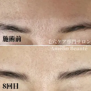 毛穴ケア専門サロン アメリオボーテのその他イメージ