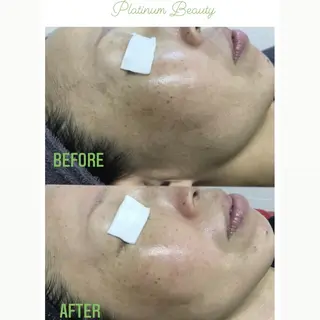 プラティーヌ ボーテのその他イメージ