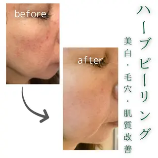 cherir 大宮のエステ・リラクイメージ