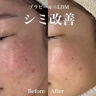 韓国肌管理&小顔 ＩＲＯＨＡのエステ・リラクイメージ