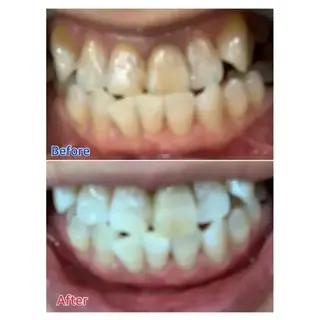 M渋谷 ホワイトニングのエステ・リラクイメージ