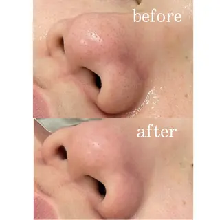 マユクリア大阪梅田店所属・マユクリア大阪梅田店 ⚪️の眉毛・アイブロウイメージ