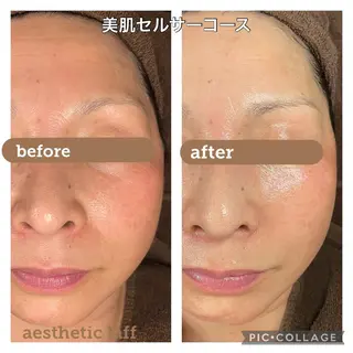 美肌作りのサロン 山村亜美のエステ・リラクイメージ